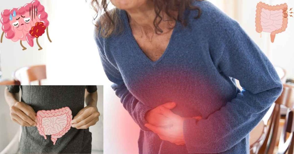 Colon Cancer Symptoms and Causes Explained